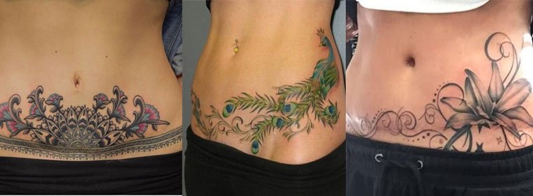 Imagens encontradas no buscador do Google tatuagem para cobrir abdominoplastia