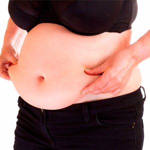 Lipoaspiração na barriga faz o que academia e dieta não dá conta. Veja como isso é possível!