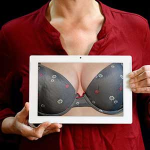 Mastopexia sem Prótese: Levantar os seios sem silicone é possível SIM!