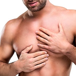 Ginecomastia Pós-operatório: dicas que fazem a diferença na sua recuperação!