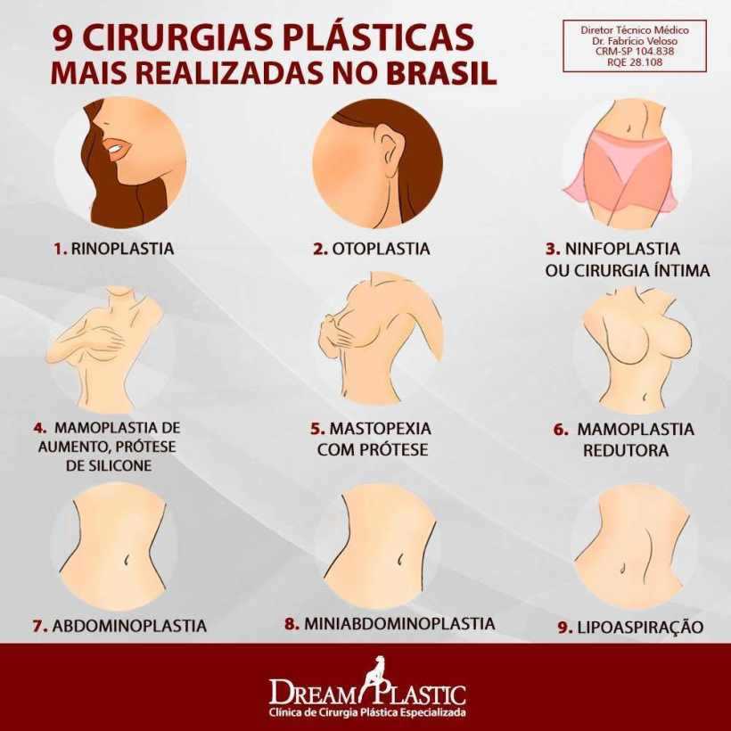 Ilustração Cirurgias plasticas populares