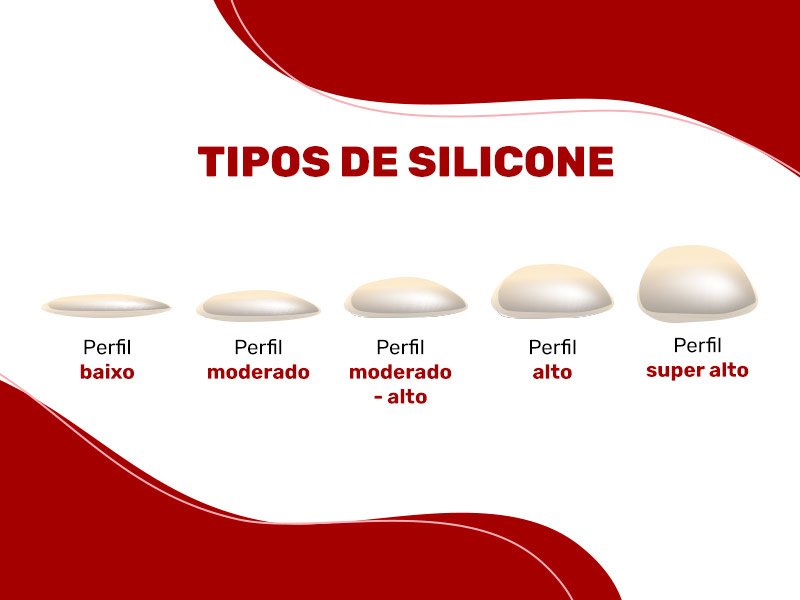 ilustração mostrando os diferentes tipos de silicone
