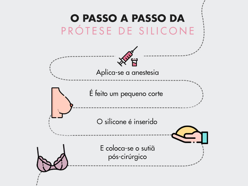 infográfico com o passo a passo da cirurgia plástica de implante de silicone