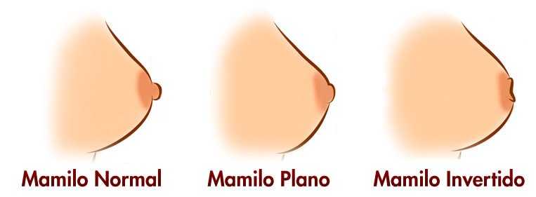 Os tipos de mamilos também podem ser diferentes tipos de mamilos