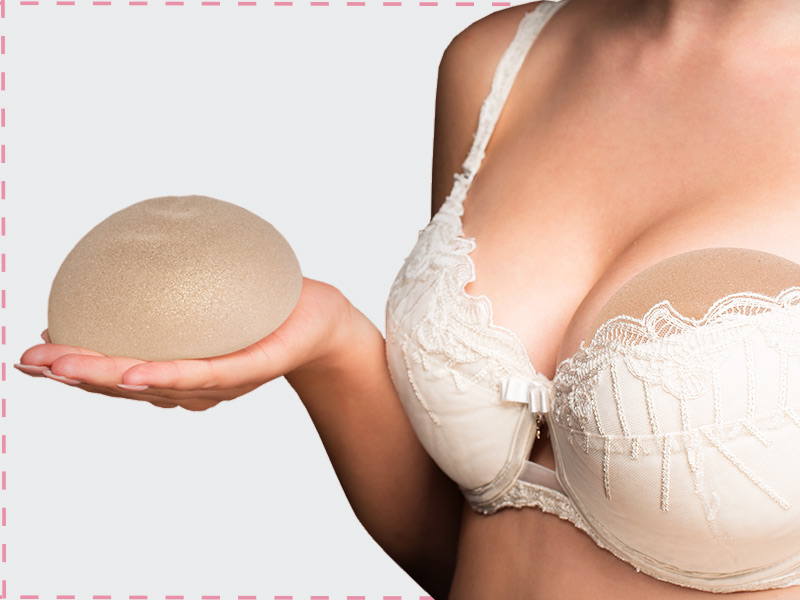 O que é a mamoplastia de aumento? mulher pós cirurgia plastica de mamoplastia de aumento segurando proteses