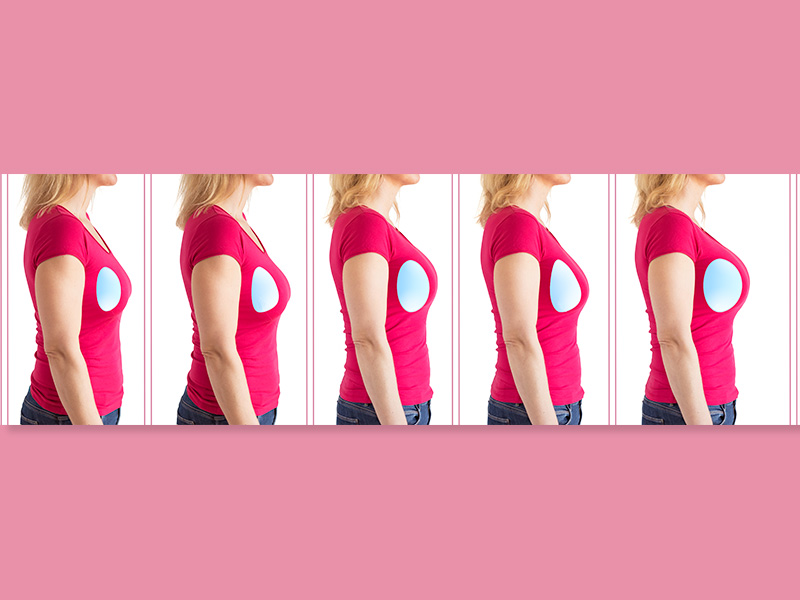 Tamanhos de silicone: pequeno ou grande? silicone pequeno