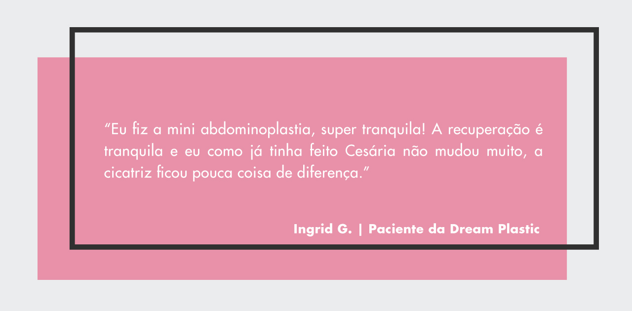 mini abdominoplastia depoimento de uma paciente da Dream Plastic