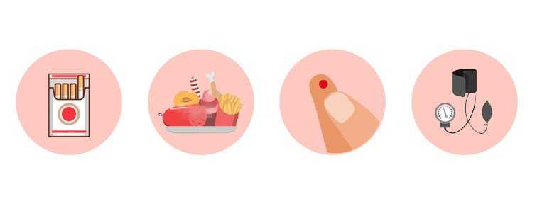Fatores que podem gerar os primeiros sinais de trombose Ilustração que mostra os fatores de risco da trombose, alimentação, diabete e pressão alta