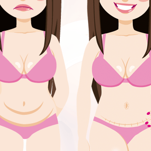 Antes e Depois da Abdominoplastia e dicas essenciais para ter um ótimo resultado!