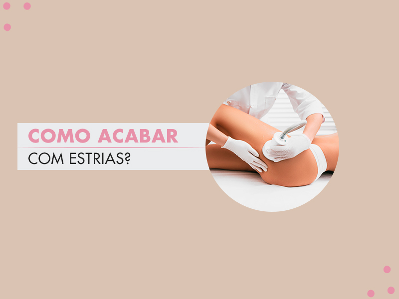 Como acabar com estrias em 2021? Tudo sobre ácido retinóico, microagulhamento, camuflagem de estrias e mais 9 procedimentos estéticos! como diminuir estrias procedimento estetico