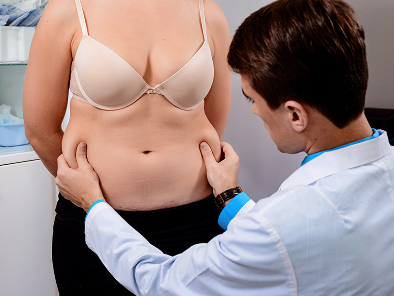 Consulta antes de fazer cirurgia de dermolipectomia médico explicando diferença entre dermolipectomia abdominoplastia