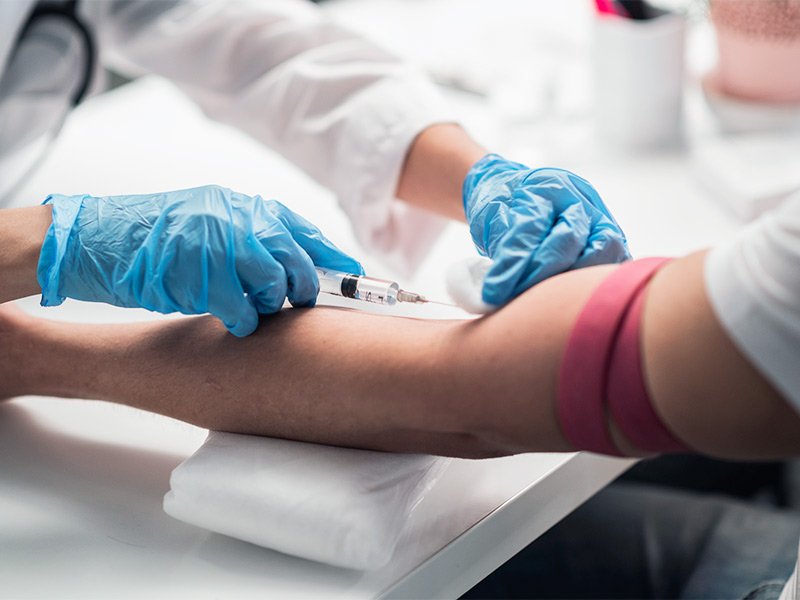 Paciente realizando um exame de sangue para o diagnóstico da trombose venosa profunda