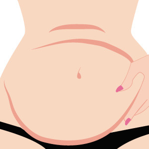 Chega de excesso de pele na barriga! Conheça dicas para prevenir e o método certo para eliminar