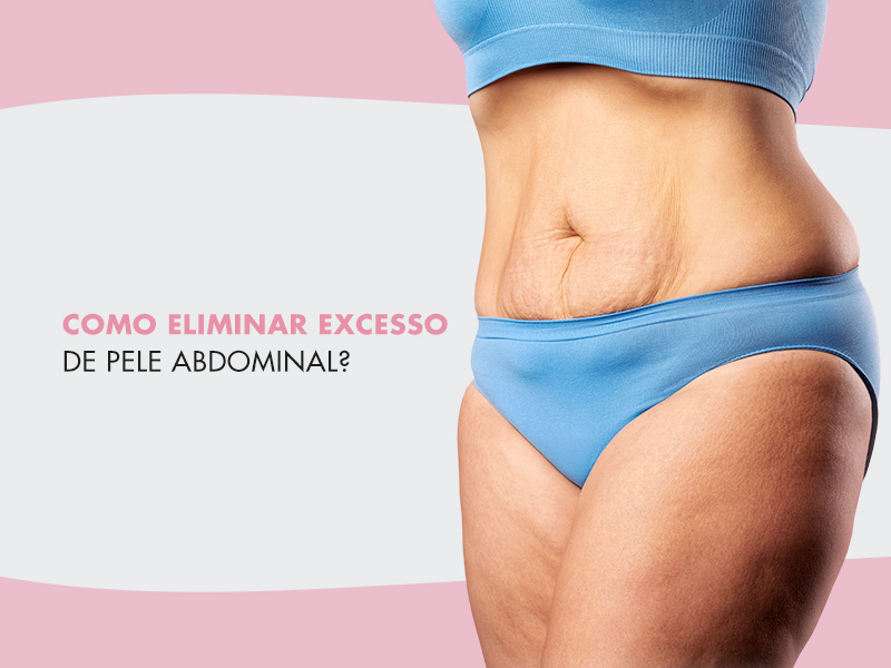 Como eliminar excesso de pele abdominal? mulher com excesso de pele na barriga