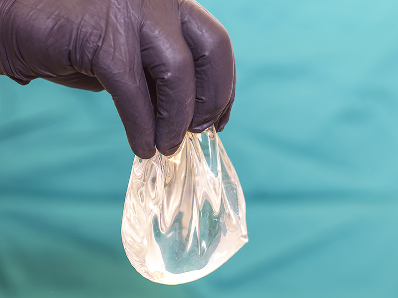 Rompimento da Prótese de mama ruptura protese silicone