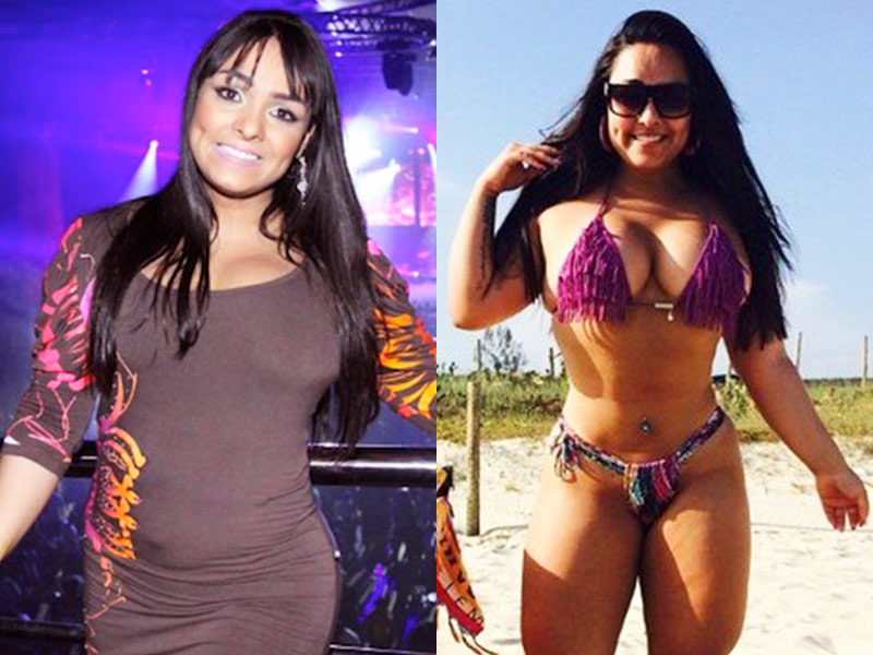 Mulher Melancia e sua lipo no bumbum! mulher melancia fez lipo