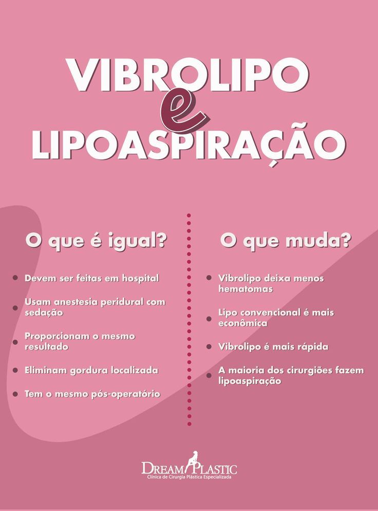 Ilustração explicando as diferenças entre a vibrolipo e a lipoaspiração tradicional