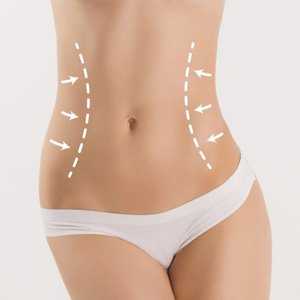 Lipoabdominoplastia: 2 técnicas combinadas para te deixar com o corpo dos seus sonhos