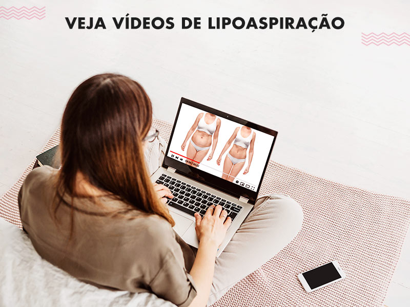 Lipoaspiração: vídeos para você conhecer detalhes preciosos da cirurgia. lipoaspiracao video