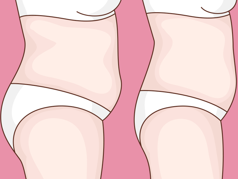 I lipo antes e depois: como ficam os resultados? i lipo resultados