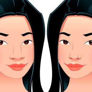 Rinoplastia: antes e depois de 7 famosas. Resultados surpreendentes para você se inspirar!