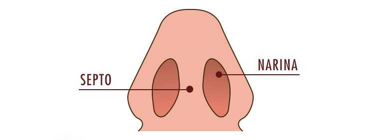 septoplastia