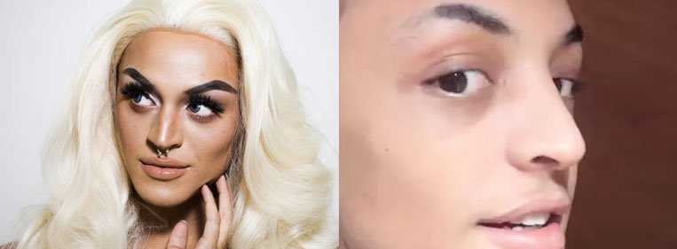 Famosos antes e depois da plástica
