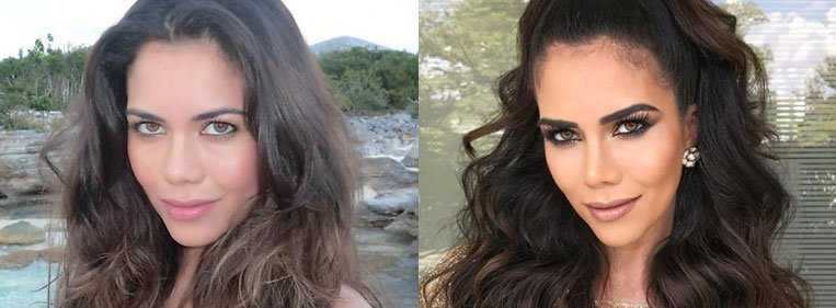 daniela albuquerque nariz antes e depois