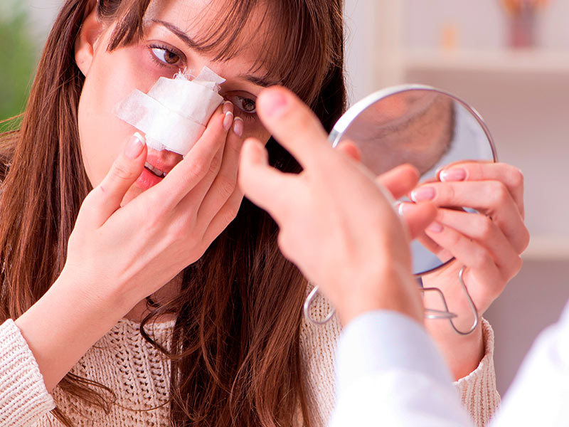 Como é o pós-operatório da rinosseptoplastia? Na imagem, uma mulher está observando os curativos no pós-operatório da rinosseptoplastia