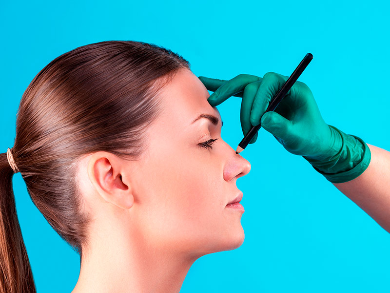 Imagem de uma paciente recebendo marcações faciais antes de se submeter a uma cirurgia de desvio septo
