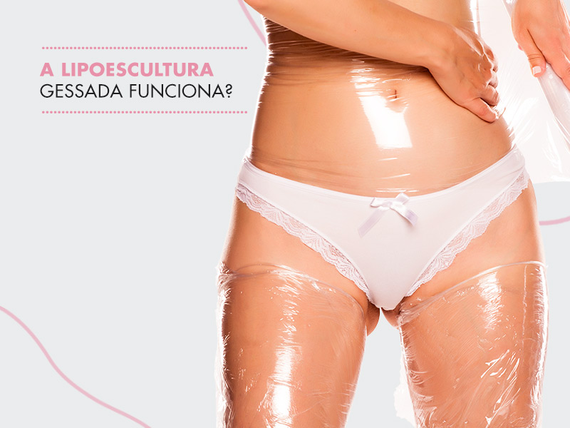 A Lipoescultura gessada funciona? Desvendamos esse mistério! lipoescultura gessada