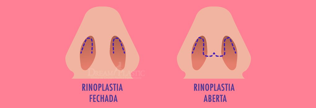 cicatriz da rinoplastia 