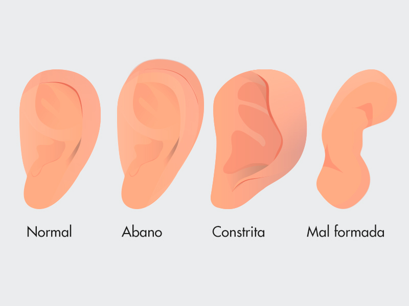 Ilustração com os 4 tipos de orelhas 