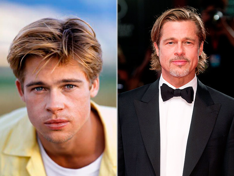 Fotos do antes e depois da cirurgia de orelha de abano do Brad Pitt