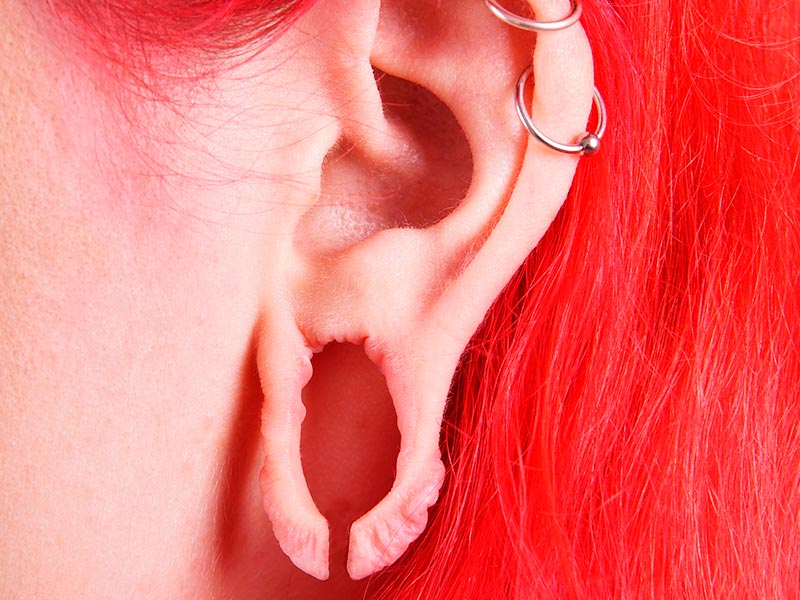 Imagem de uma mulher com a orelha rasgada na região do lóbulo