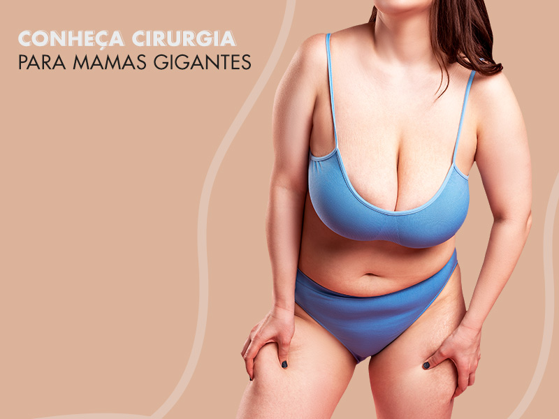 Gigantomastia: tudo sobre a cirurgia para reduzir seios enormes! gigantomastia