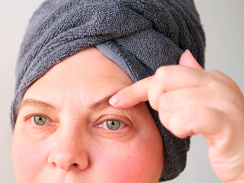 Imagem de uma mulher de meia idade com a pálpebra caída levantando o excesso de pele nos olhos com o dedo indicador 