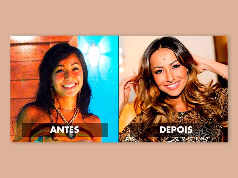 antes depois cantopexia