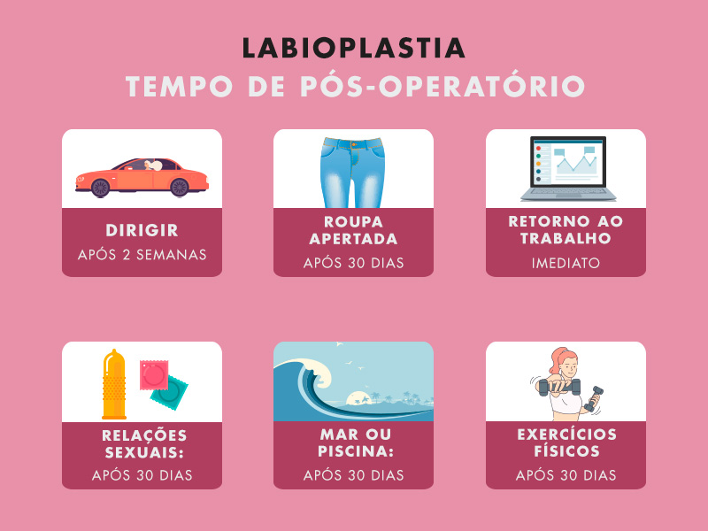 Recomendações para a recuperação da labioplastia Infográfico com as orientações sobre o tempo de pós-operatório labioplastia
