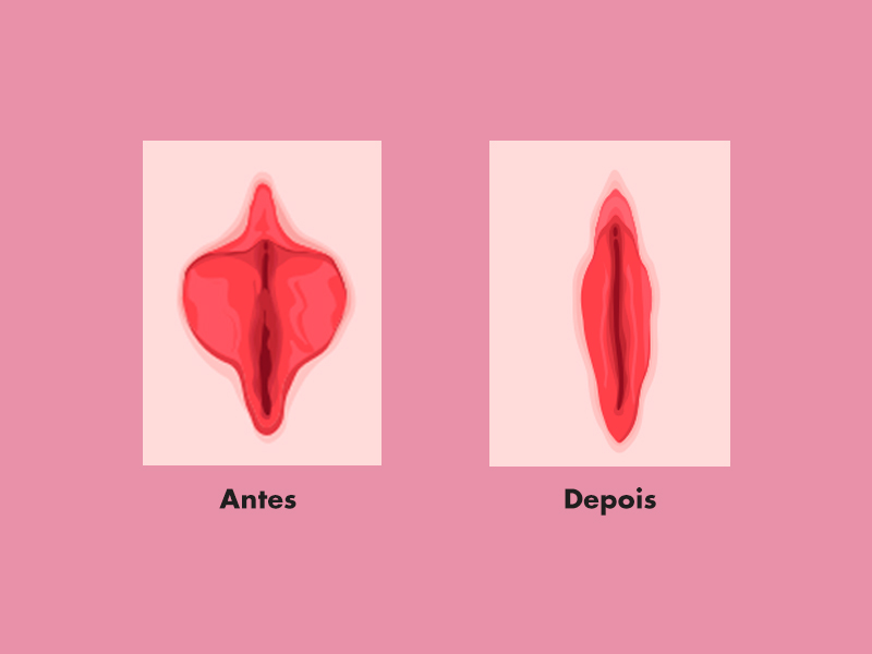 Como pintar los labios para que parezcan mas gruesos