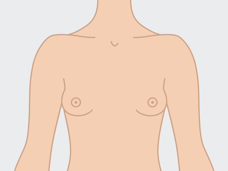 ilustração mostrando seios separados