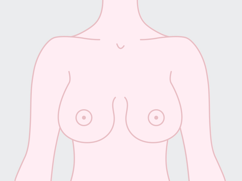 tipos peito em sino é mostrado na ilustração