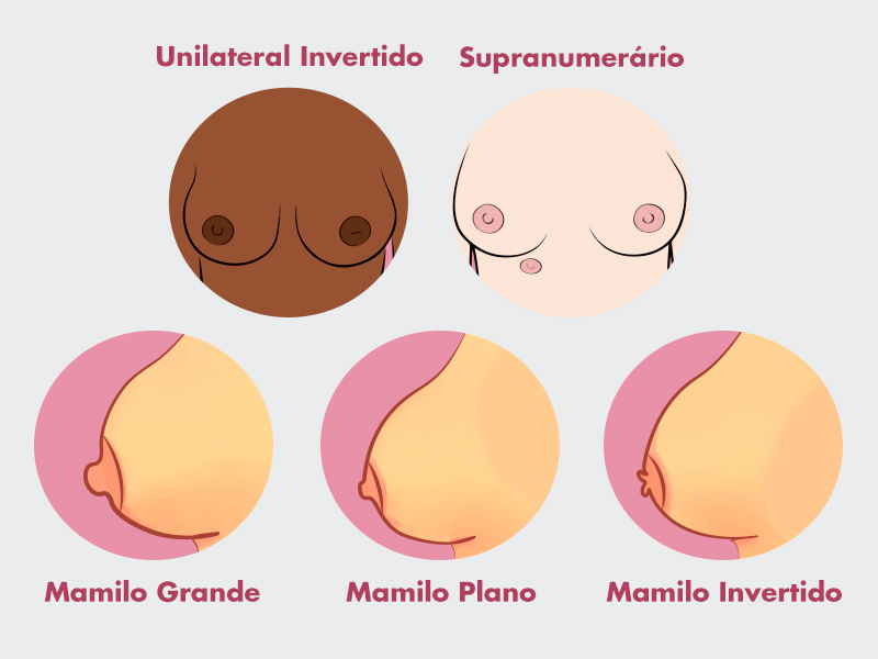 ilustração com diferentes tipos de mamilos