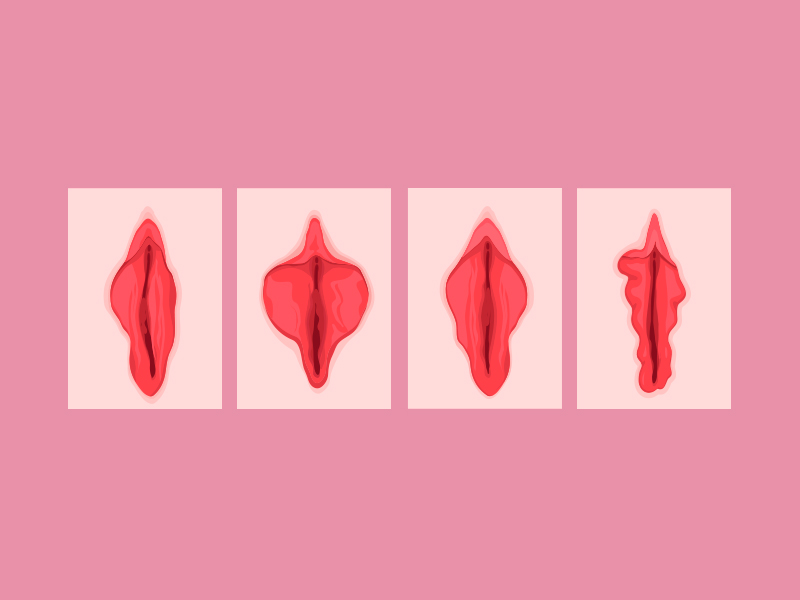 vagina labios grandes