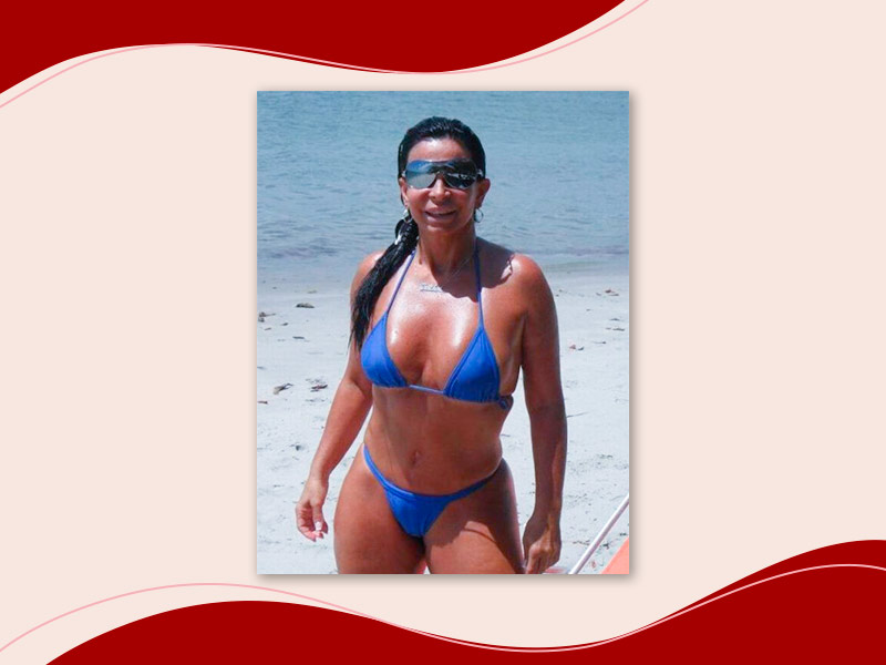 Gretchen mostra o resultado da Abdominoplastia em uma praia, ela usa um biquíni azul e está sorrindo e posando para a foto.