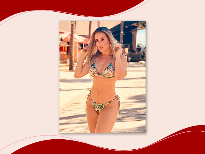 Ex-BBB Patrícia Leite mostrando o antes e depois de sua abdominoplastia em uma praia, ela usa um biquíni estampado e está posando para foto.