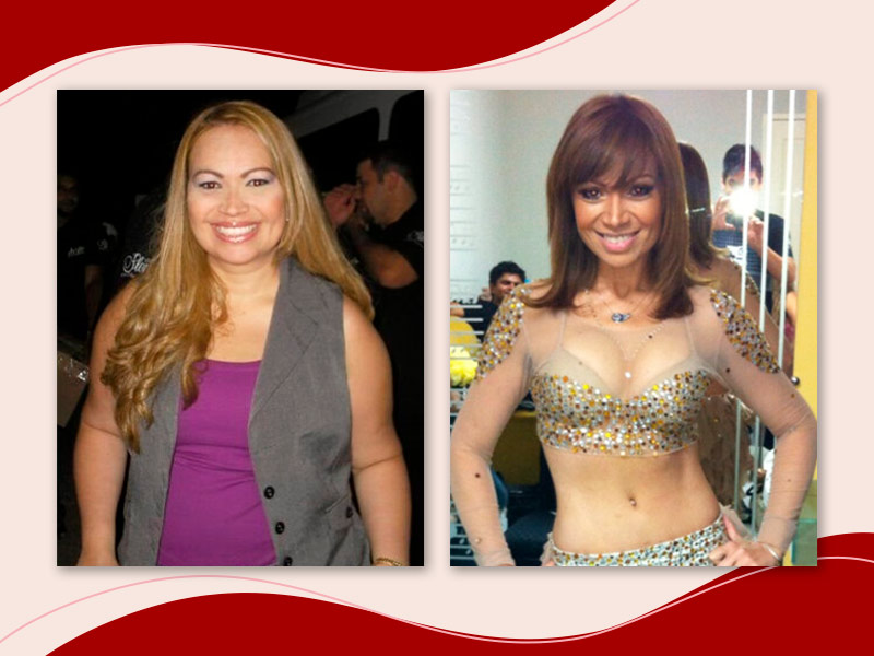 Solange Almeida antes e depois da abdominoplastia. Primeiro, com uma blusa roxa, tampando sua barriga, a segunda foto mostra ela de biquíni.
