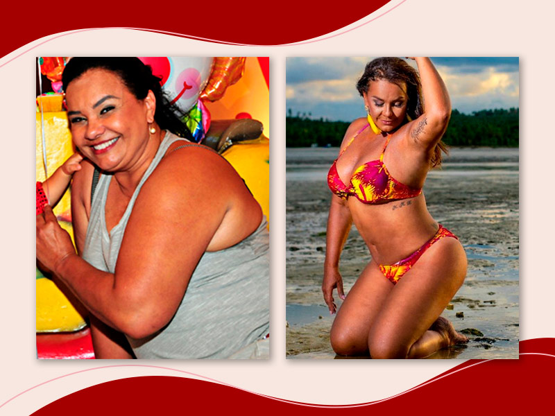Fotos da Solange Couto antes e depois da cirurgia, com a primeira foto ela de regata cinza se cobrindo e a segunda a diva posando na praia usando um biquíni vermelho e amarelo mostrando o resultado da Abdominoplastia.