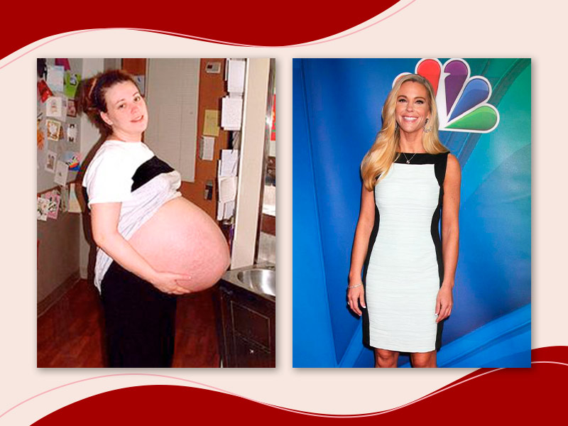 Kate Gosselin antes e depois, mostrando a barriga de sêxtuplos e depois ela usando um vestido tubinho