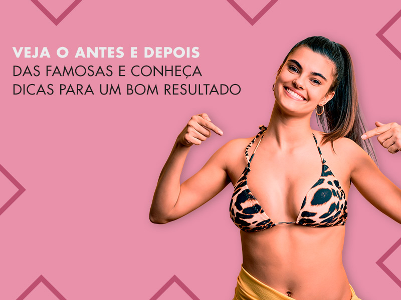 Cirurgia Plástica Antes e Depois: Veja fotos das famosos antes e depois da plástica e dicas para ter um resultado dos seus sonhos cirurgia plastica antes depois